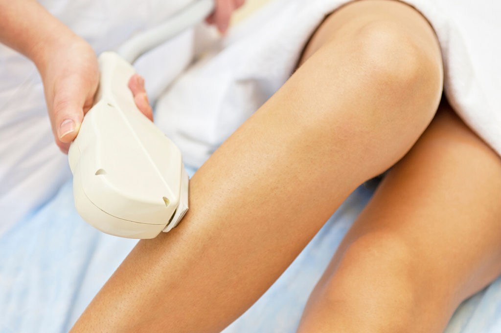 IPL and laser hair removal London