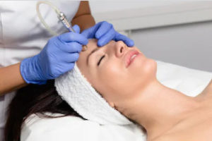 microdermabrasion for skin treatment in London